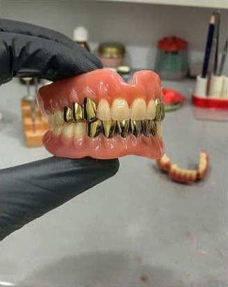 دندان مصنوعی 